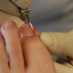 Semáforos viejos y fundidos causan al día tres accidentes